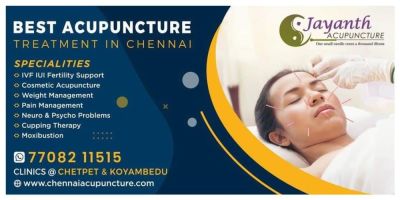 Acupuncture Treatment in Chennai